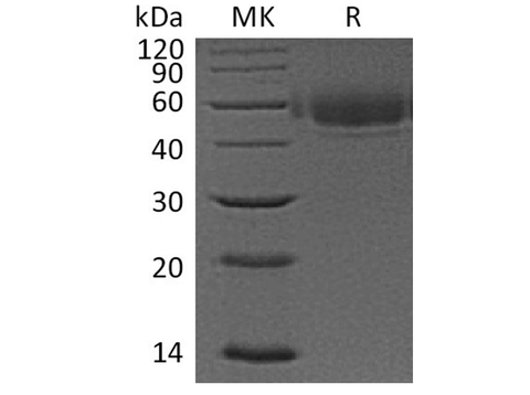 Recombinant Human VSIG4 Protein (His Tag) - ABMIUM