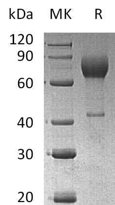 Recombinant Mouse IL2Ra/CD25 Protein (Fc Tag) - ABMIUM