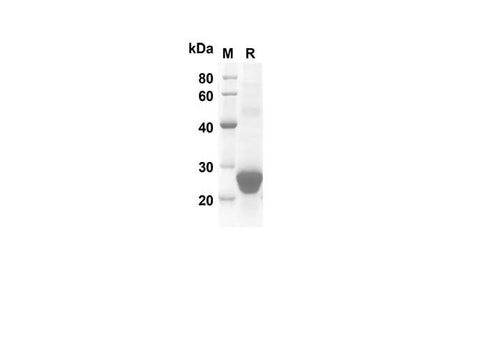 SDS-PAGE analysis of Mouse CD70 proteins, 2 μg/lane of Recombinant Mouse CD70 proteins was resolved with SDS-PAGE under reducing conditions, showing bands at 16.2 kDa.