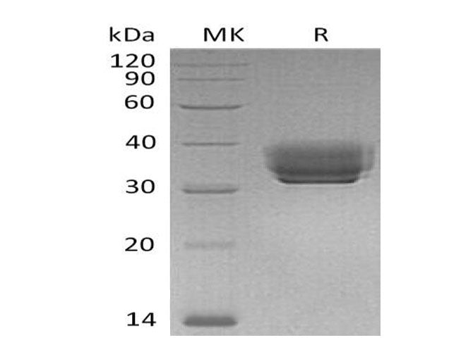 Recombinant Mouse Butyrophilin 1A1/BTN1A1 Protein (His Tag) - ABMIUM