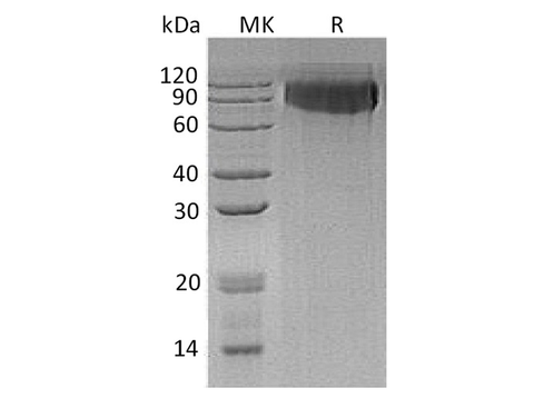Recombinant Human GPNMB Protein (aa 22-486, His Tag) - ABMIUM