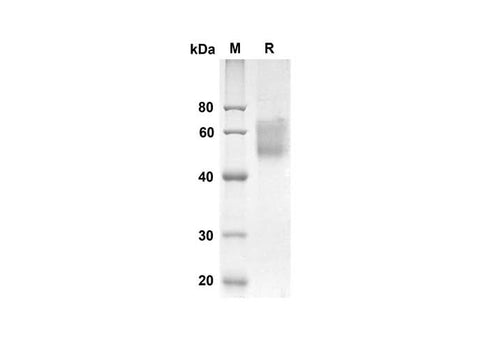 SDS-PAGE analysis of Human SELL proteins, 2 μg/lane of Recombinant Human SELL proteins was resolved with an SDS-PAGE under reducing conditions, showing bands at 32.2 kDa.