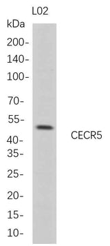 Anti-Human CECR5 Antibody [B684]