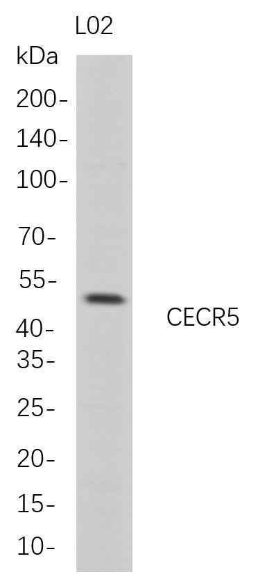Anti-Human CECR5 Antibody [B684]