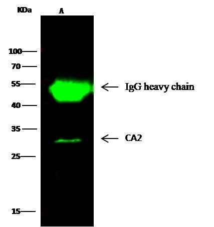Anti-Human CA2 Antibody [B108] - ABMIUM