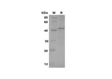 SDS-PAGE analysis of Mouse TNF RI/TNFRSF1A proteins, 2 μg/lane of Recombinant Mouse TNF RI/TNFRSF1A proteins was resolved with SDS-PAGE under reducing conditions, showing bands at 45 kDa.