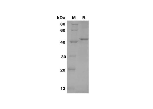 SDS-PAGE analysis of Mouse TNF RI/TNFRSF1A proteins, 2 μg/lane of Recombinant Mouse TNF RI/TNFRSF1A proteins was resolved with SDS-PAGE under reducing conditions, showing bands at 45 kDa.