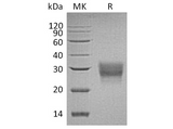 Recombinant Human CD8 beta/CD8B Protein (His Tag) - ABMIUM