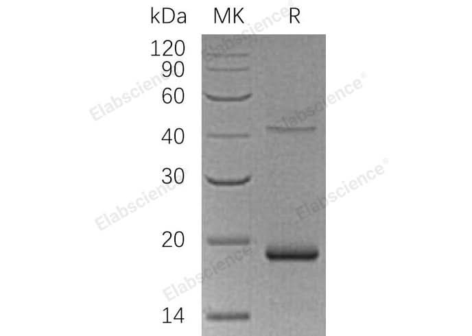 Recombinant Human UPP1 Protein (His Tag) - ABMIUM