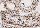 Anti-Human Sox2 Antibody [A1247] - ABMIUM