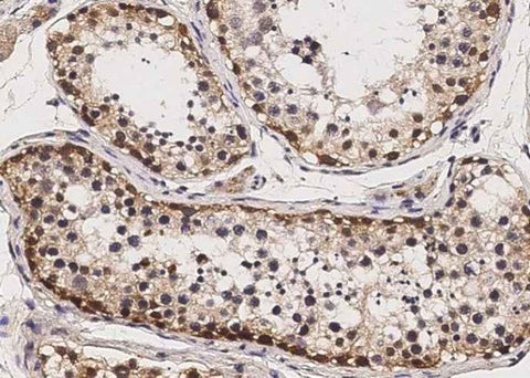 Anti-Human Sox2 Antibody [A1247] - ABMIUM