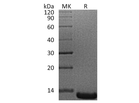 Recombinant Human ACYP1 Protein (His Tag) - ABMIUM