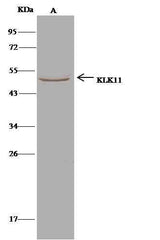 Anti-Human KLK11 Antibody [B122]