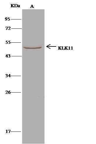 Anti-Human KLK11 Antibody [B122] - ABMIUM