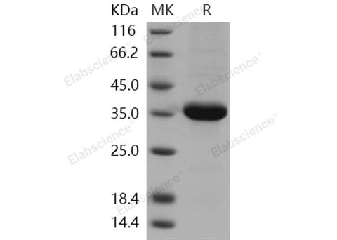 Recombinant Human ACBD6 Protein (His Tag) - ABMIUM
