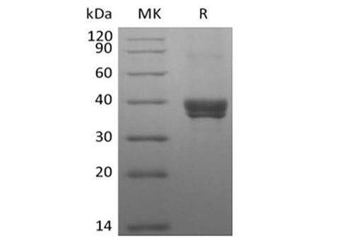 Recombinant Human DC-SIGNR/CD299 (N-8His-Flag) - ABMIUM