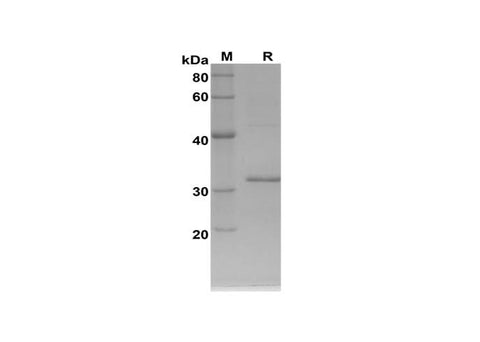 SDS-PAGE analysis of Rat FGA proteins, 2 μg/lane of Recombinant Rat FGA proteins was resolved with SDS-PAGE under reducing conditions, showing bands at 32 kDa.