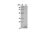SDS-PAGE analysis of Human CGA proteins, 2 μg/lane of Recombinant Human CGA proteins was resolved with SDS-PAGE under reducing conditions, showing bands at 12 kDa.