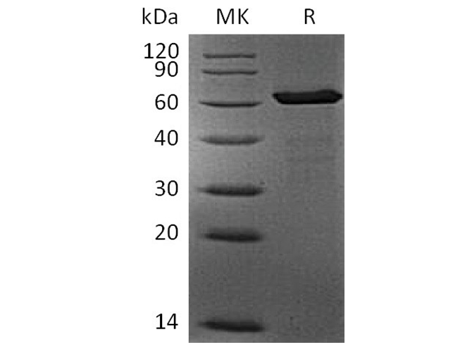 Recombinant Human FGL1 Protein (mFc Tag) - ABMIUM