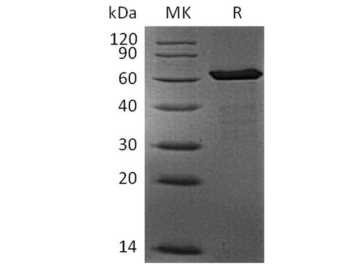 Recombinant Human FGL1 Protein (mFc Tag) - ABMIUM
