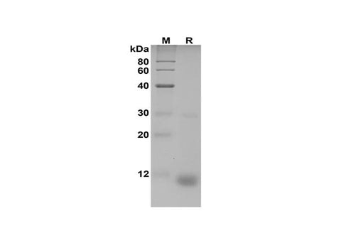 SDS-PAGE analysis of Bovine S100A7/PSOR1 proteins, 2 μg/lane of Recombinant Bovine S100A7/PSOR1 proteins was resolved with SDS-PAGE under reducing conditions, showing bands at 11 kDa.