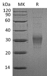 Recombinant Mouse CD16-2/FCGR4 Protein (His Tag) - ABMIUM