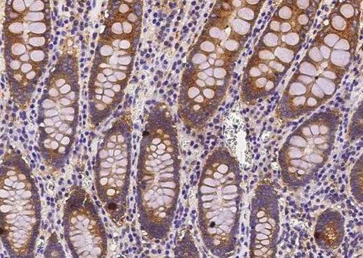 Anti-Human COMMD9 Antibody [B202] - ABMIUM