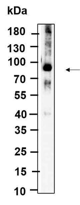 Anti-Human/Mouse/Rat ALDH16A1 Antibody [B963]