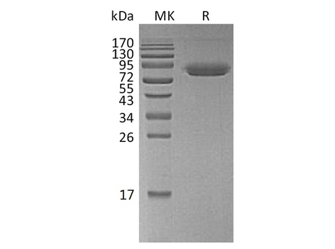 Recombinant Human CD47/IAP Protein (Fc & Avi Tag) - ABMIUM