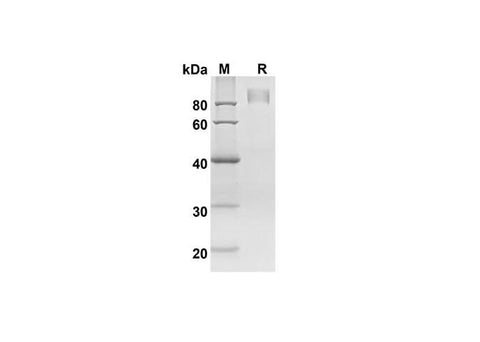 SDS-PAGE analysis of Mouse AXL/UFO proteins, 2 μg/lane of Recombinant Mouse AXL/UFO proteins was resolved with SDS-PAGE under reducing conditions, showing bands at 71.8 kDa.