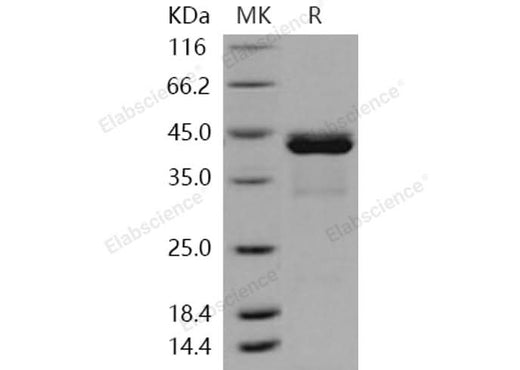 Recombinant Human CALML5/CLSP Protein (His & GST Tag) - ABMIUM