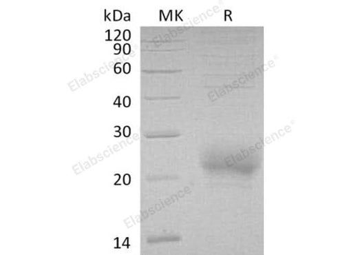Recombinant Human CD160/BY55 Protein (aa 27-159, His Tag) - ABMIUM