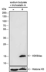 Anti-Human/Rat/Mouse Histone H3 (Acetyl Lys64) Antibody [A108]