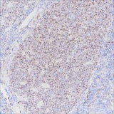 Anti-Human LMO2 Antibody [A286]