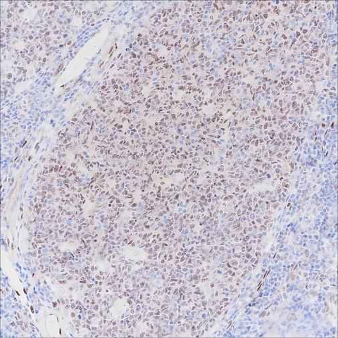 Anti-Human LMO2 Antibody [A286] - ABMIUM