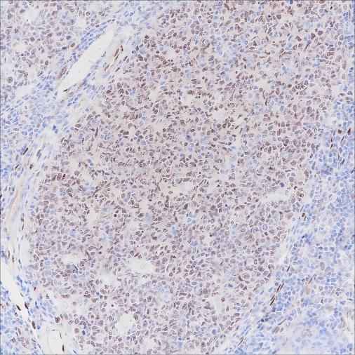 Anti-Human LMO2 Antibody [A286] - ABMIUM