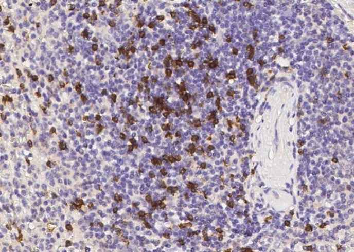 Anti-Human CD8B Antibody [B134] - ABMIUM