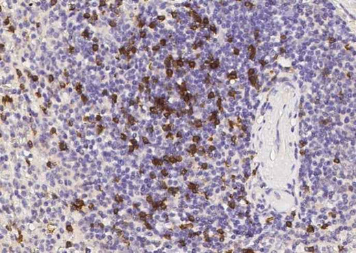 Anti-Human CD8B Antibody [B134] - ABMIUM