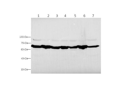 Anti-Human/mouse/Rat HSPA9 Antibody - ABMIUM