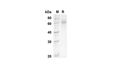 SDS-PAGE analysis of Human PSAP proteins, 2 μg/lane of Recombinant Human PSAP proteins was resolved with SDS-PAGE under reducing conditions, showing bands at 57.5 kDa.