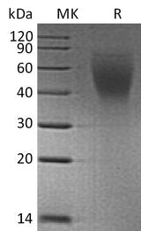 Recombinant Human CA125/MUC16 (C-6His) - ABMIUM