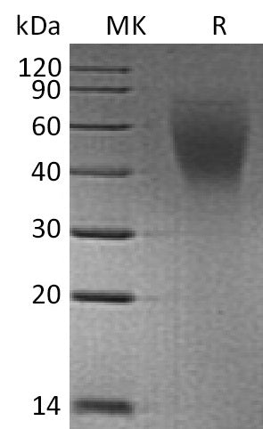 Recombinant Human CA125/MUC16 (C-6His) - ABMIUM