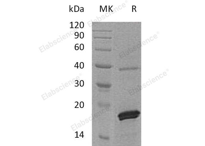 Recombinant Human PRL-2/PTP4A2 Protein (His Tag) - ABMIUM