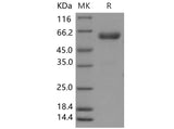 Recombinant Mouse CHODL/Chondrolectin Protein (Fc Tag) - ABMIUM