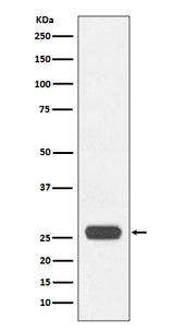 Anti-GST-Tag Rabbit Monoclonal Antibody Boster Bio