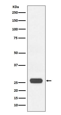 Anti-GST-Tag Rabbit Monoclonal Antibody Boster Bio