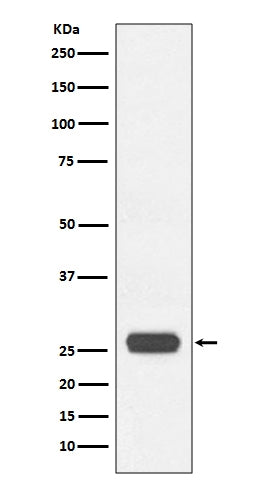 Anti-GST-Tag Rabbit Monoclonal Antibody Boster Bio