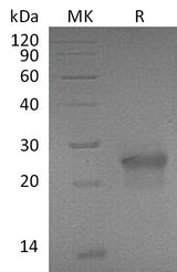 Recombinant Mouse XEDAR/EDA2R Protein (His Tag) - ABMIUM