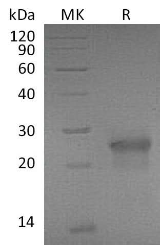 Recombinant Mouse XEDAR/EDA2R Protein (His Tag) - ABMIUM