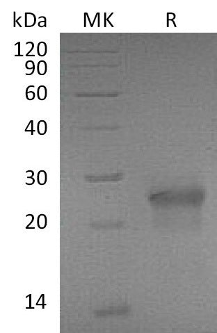 Recombinant Mouse XEDAR/EDA2R Protein (His Tag) - ABMIUM